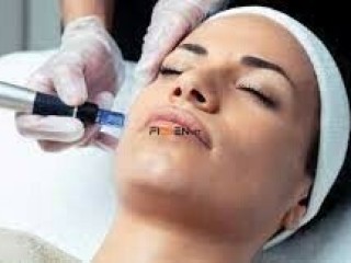 DERMAPEN EN SALÓN CAROLINAS