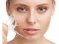 peeling-facial-en-salon-carolinas-small-0