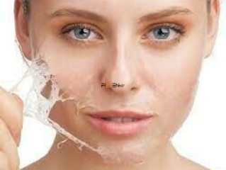 Peeling facial en salón Carolinas