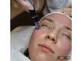 dermapen-y-bb-glow-salon-carolinas-small-1