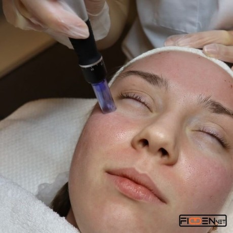 dermapen-y-bb-glow-salon-carolinas-big-1