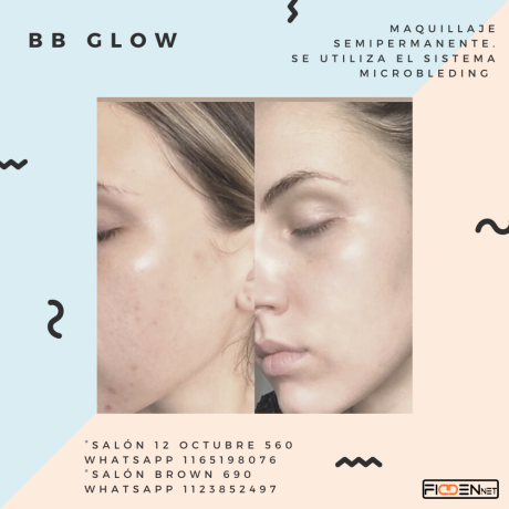 dermapen-y-bb-glow-salon-carolinas-big-0