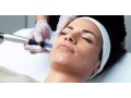 dermapen-con-hilos-tensores-y-microblading-de-cejas-y-dermolips-labios-small-1