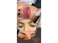 dermapen-con-hilos-tensores-y-microblading-de-cejas-y-dermolips-labios-small-3