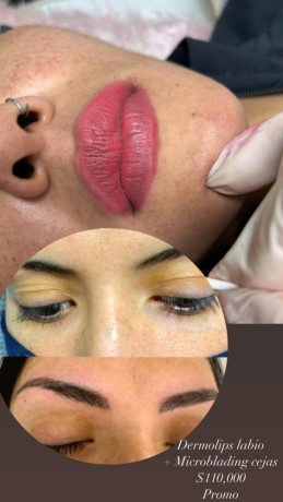 dermapen-con-hilos-tensores-y-microblading-de-cejas-y-dermolips-labios-big-3